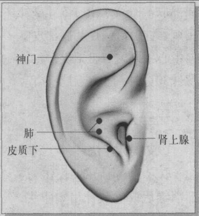 第十二節(jié) 神經(jīng)性皮炎